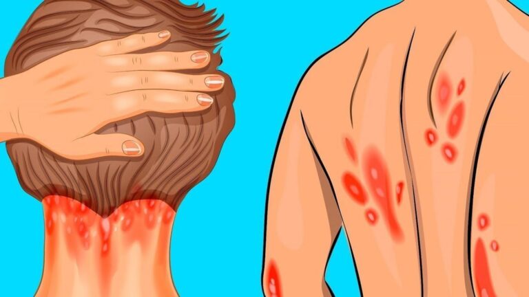 Diese Anzeichen eines Vitamin D Mangels könnten deine Gesundheit nachhaltig verändern…