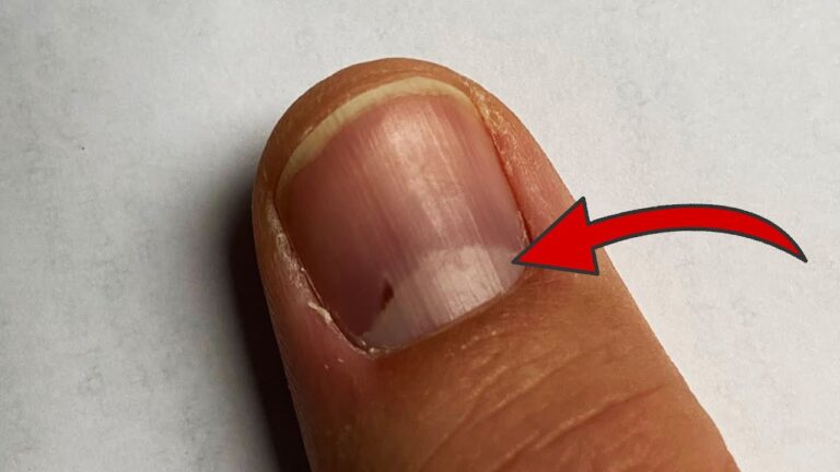 Entdecke 5 Geheimnisse über den Halbmond auf deinem Fingernagel!