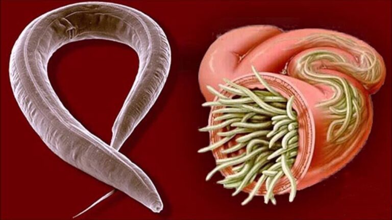 10 effektive Heilmittel gegen Parasiten für ein gesundes Leben